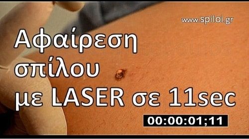 Ενημερωτικά Βίντεο Για Την Πλαστική Χειρουργική