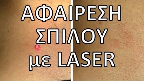 Ενημερωτικά Βίντεο Για Την Πλαστική Χειρουργική
