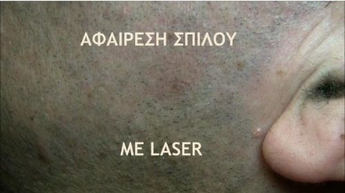 Ενημερωτικά Βίντεο Για Την Πλαστική Χειρουργική