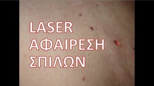 Ενημερωτικά Βίντεο Για Την Πλαστική Χειρουργική