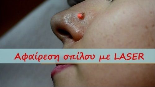 Ενημερωτικά Βίντεο Για Την Πλαστική Χειρουργική