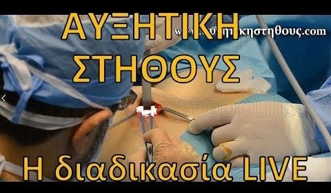 Ενημερωτικά Βίντεο Για Την Πλαστική Χειρουργική
