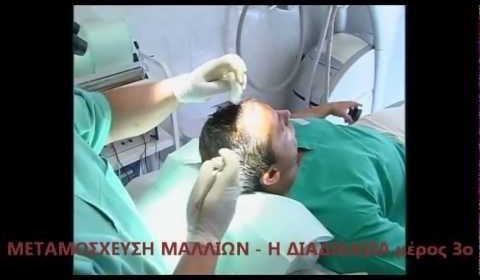 Ενημερωτικά Βίντεο Για Την Πλαστική Χειρουργική