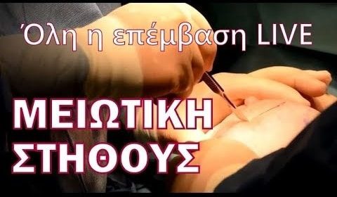 Ενημερωτικά Βίντεο Για Την Πλαστική Χειρουργική