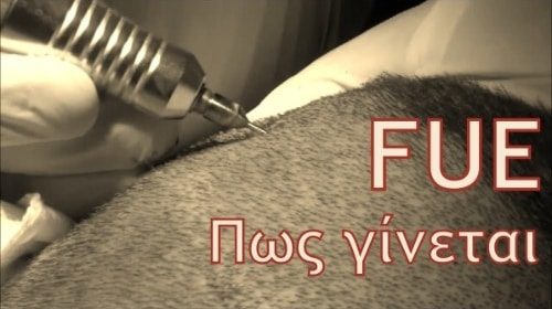 Ενημερωτικά Βίντεο Για Την Πλαστική Χειρουργική