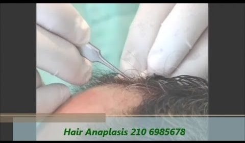 Ενημερωτικά Βίντεο Για Την Πλαστική Χειρουργική