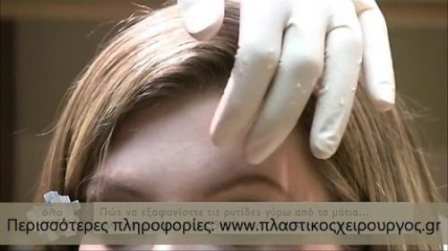 Ενημερωτικά Βίντεο Για Την Πλαστική Χειρουργική