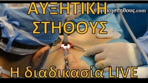 Ενημερωτικά Βίντεο Για Την Πλαστική Χειρουργική