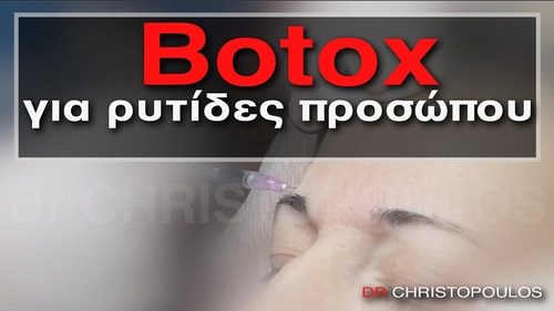 Botox για ρυτίδες προσώπου