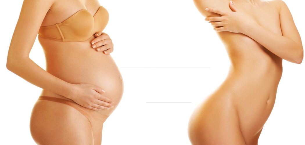 Mommy Makeover - Πλαστική χειρουργική μετά από εγκυμοσύνη