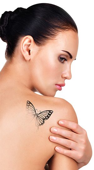 Αφαίρεση tattoo
